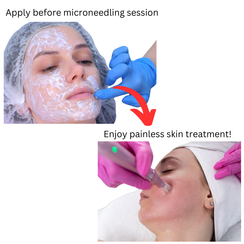 MELAO Microneedling Numb Cream - Works for skin and scalp